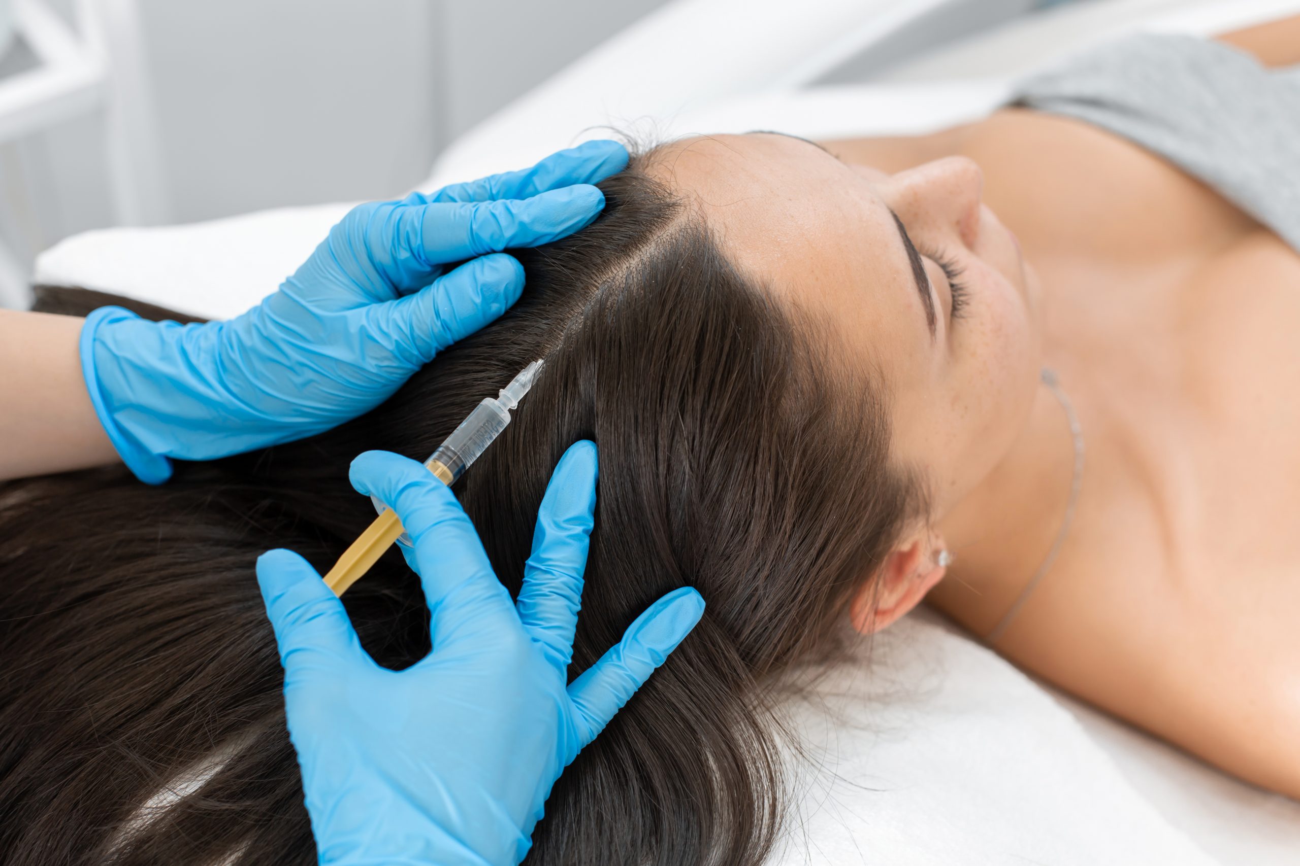 Forefront Dermatology Aesthetic Center  Introducing PRP Injections For Hair  Loss PRP Platelet Enriched Plasma therapy for hair loss is the latest  trend for hair growth and hair loss treatments It a