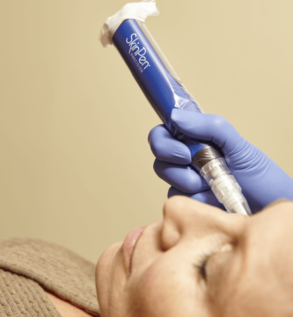 SKINPEN MICRONEEDLING IN GLENDALE, AZ | Vida Bella Medspa