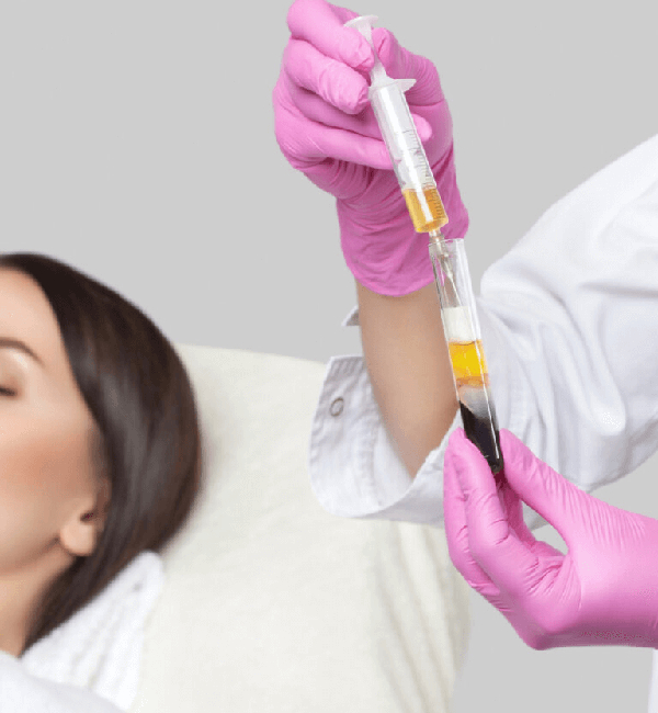 PRF (Platelet-Rich Fibrin) IN GLENDALE, AZ | Vida Bella Medspa
